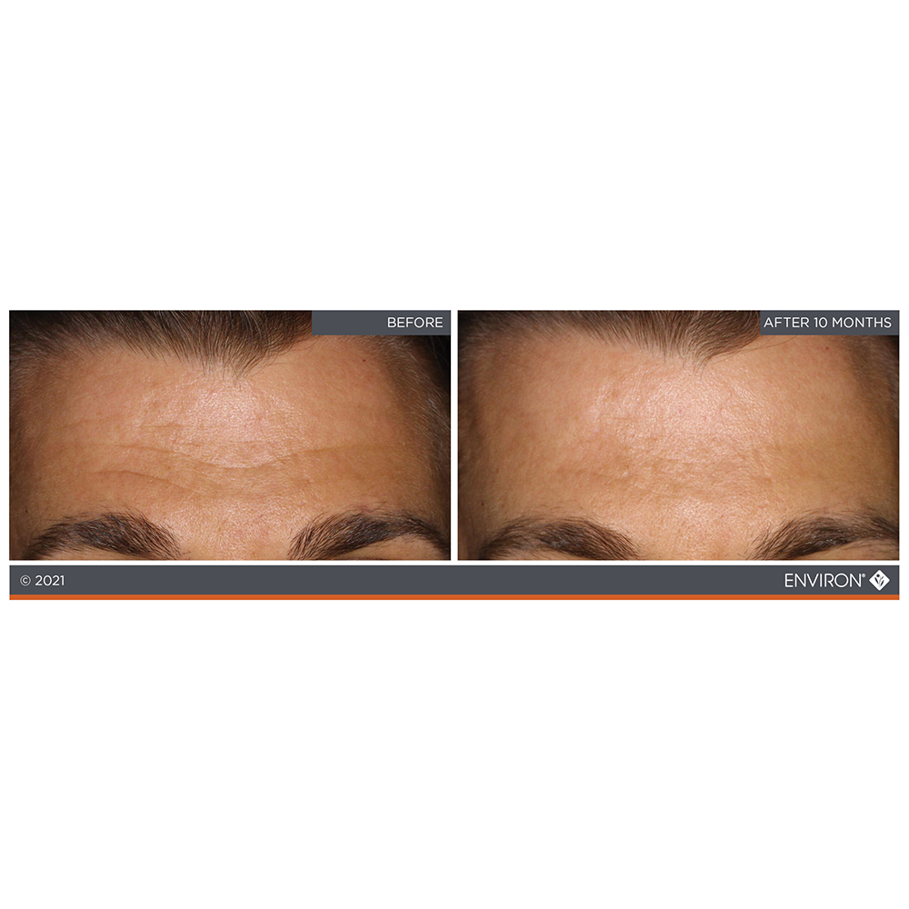 Environ HA Intensive Serum Hyaluronic | Bella Reina Spa | Authorized Stockist (3)